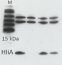 HliA | high light inducible protein